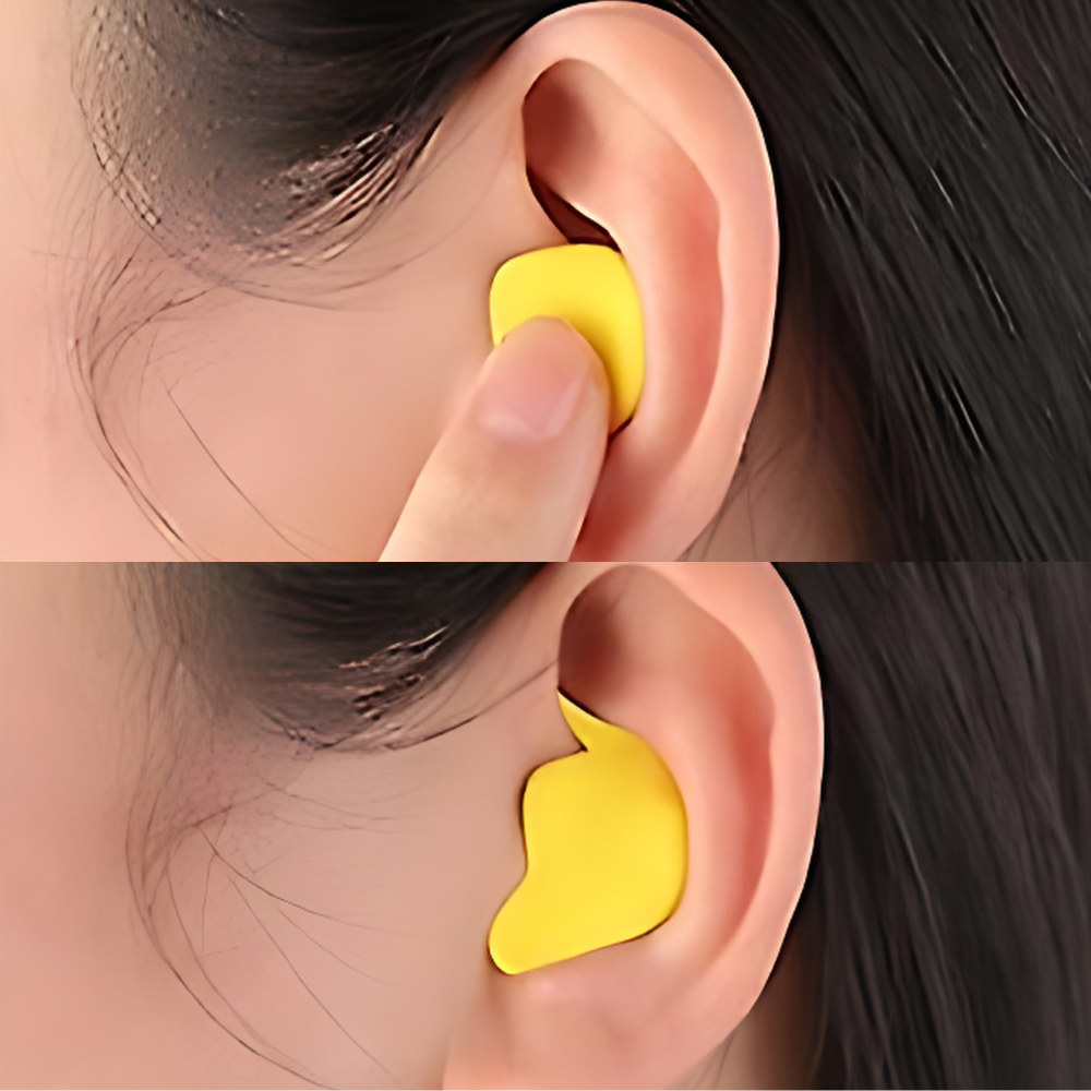 RYNX | Soundproof Earplugs for Optimal Comfort