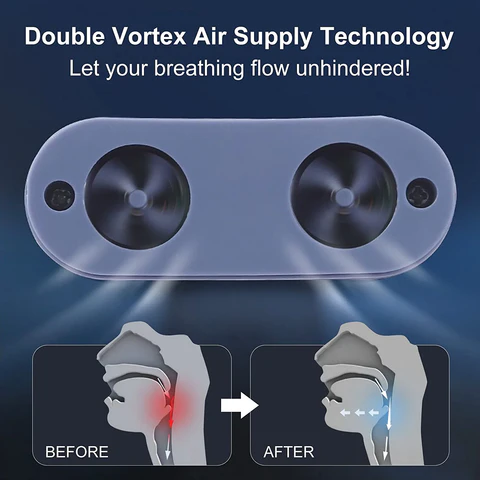 RYNX | Micro Cpap Sleep Apnea Machine For Travel & Anti-Snoring - Cpap Alternative