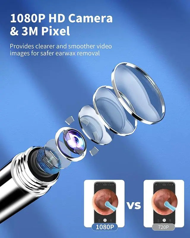 Rynx | HD Earwax Removal Spoon — Wireless Otoscope with LED Light