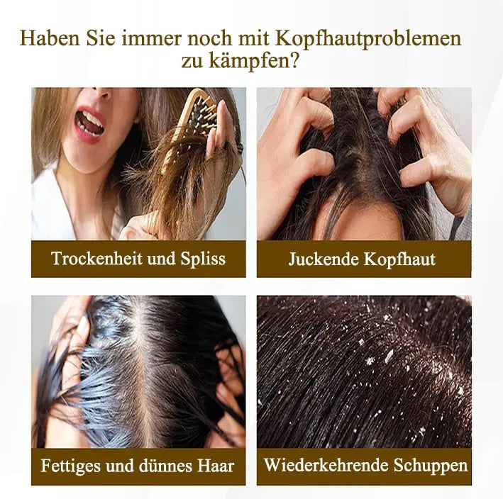 Rynx | Scalp Massage Comb – Gentle Dandruff Removal & Care
