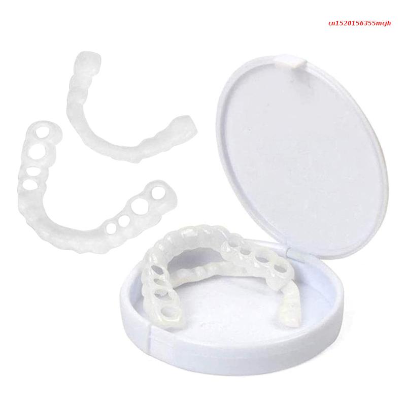 RYNX | Smilesnap - Always The Perfect Smile With These Veneers