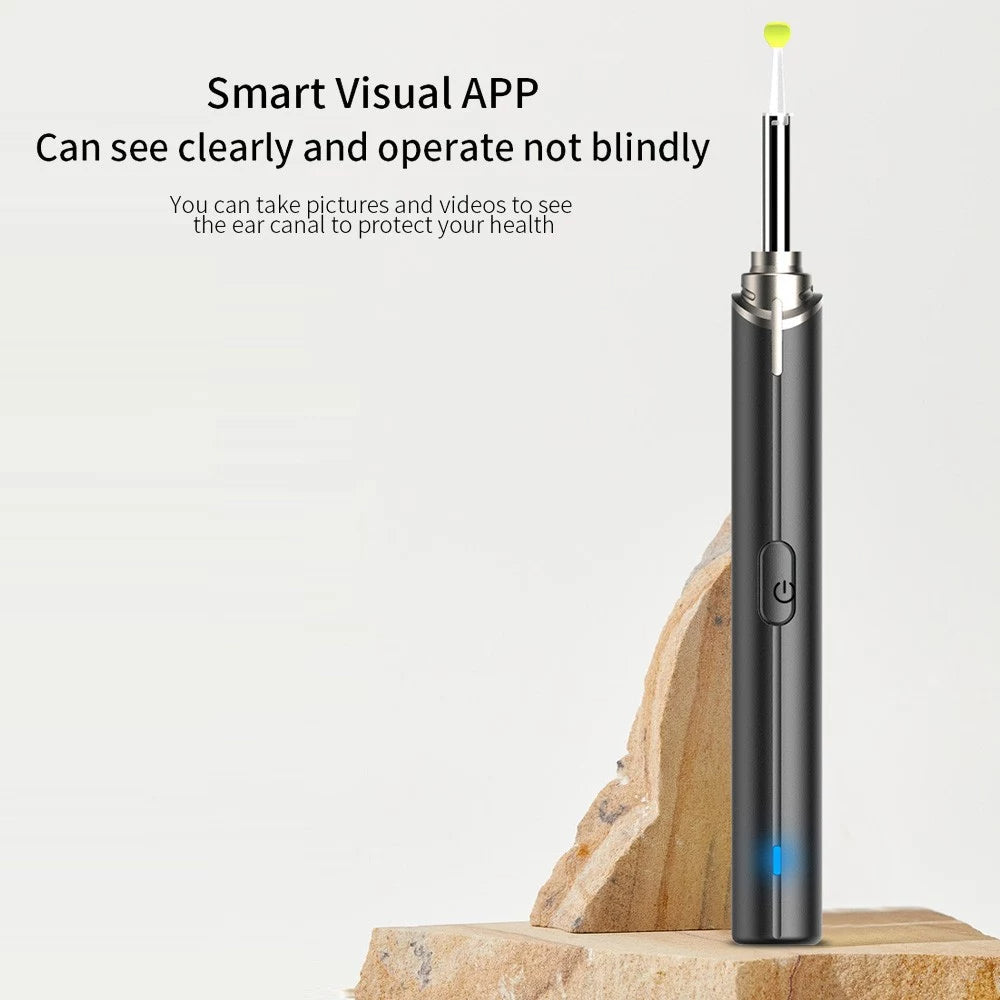 Rynx | Intelligent Visual Ear Otoscope Inspection Tool