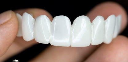 RYNX | Dental Prosthesis