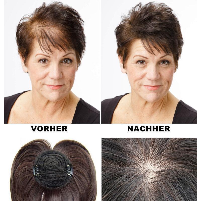 RYNX | Special Head Hairpiece
