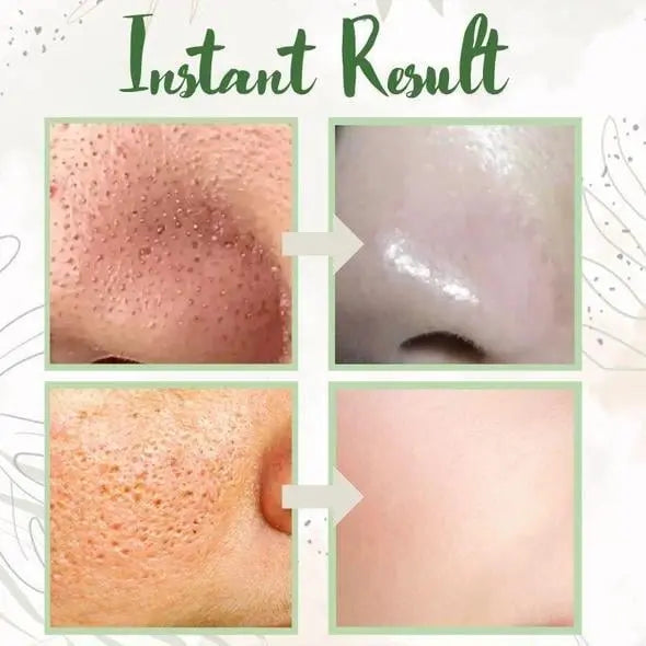 Rynx | Green Tea Deep Cleansing Mask – Against Sebum, Dirt & Clogged Pores