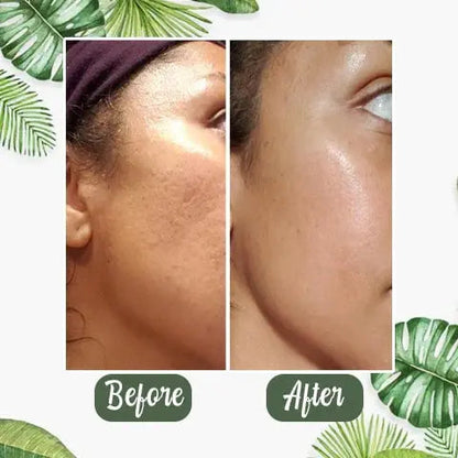 Rynx | Green Tea Deep Cleansing Mask – Against Sebum, Dirt & Clogged Pores