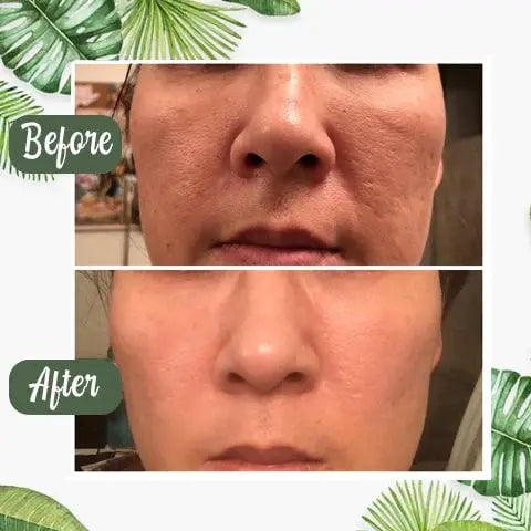 Rynx | Green Tea Deep Cleansing Mask – Against Sebum, Dirt & Clogged Pores