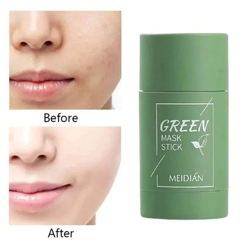 Rynx | Green Tea Deep Cleansing Mask – Against Sebum, Dirt & Clogged Pores