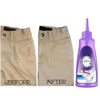 Rynx | Stain remover for clothing – strong against dirt