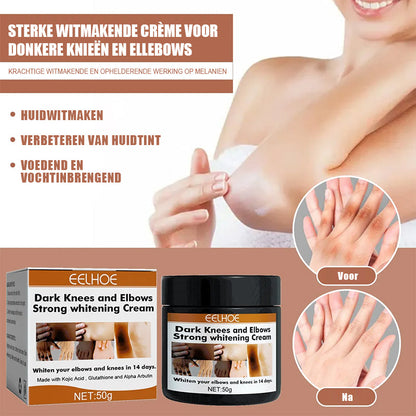 Rynx | Knees And Elbows Strong Bleach Cream