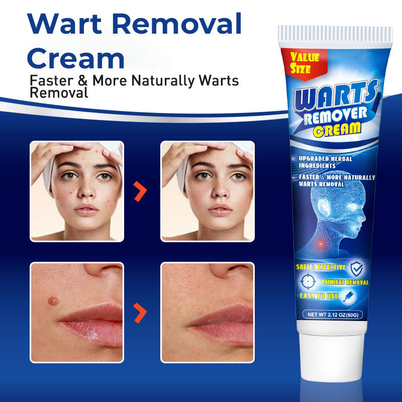 RYNX | Wart Removal Facial Cream 1 PIECE