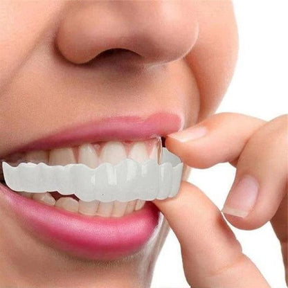 Rynx | Smile Veneer (Top & Bottom Included)