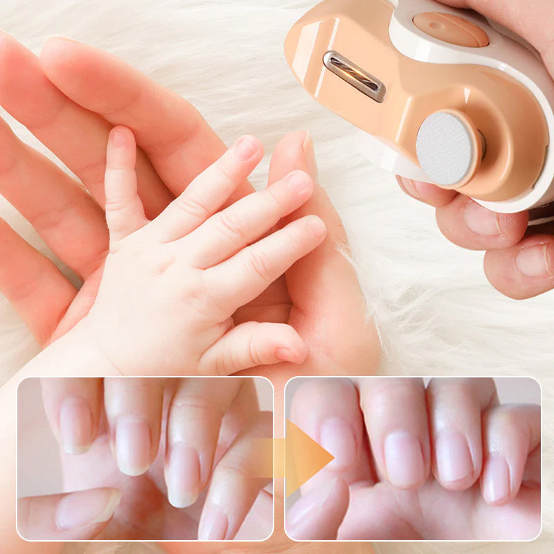 Rynx | 2-in-1 Electric Nail Clipper