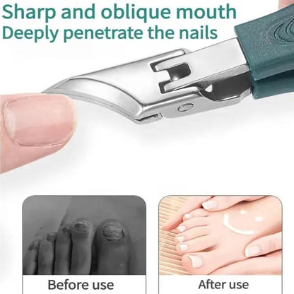 Rynx | 3-piece nail care set for ingrown nails