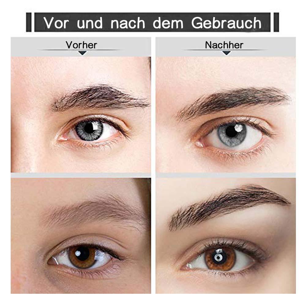 Rynx | Flawless electric facial hair remover eyebrow trimmer