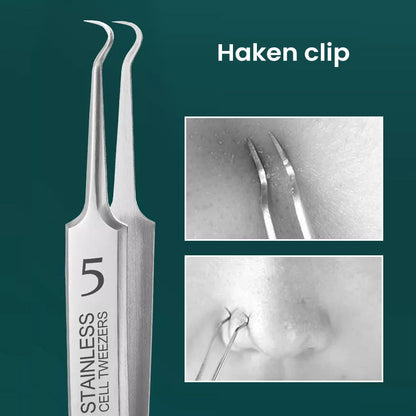 Rynx | Professional High-Precision Clip for Removing Blackheads