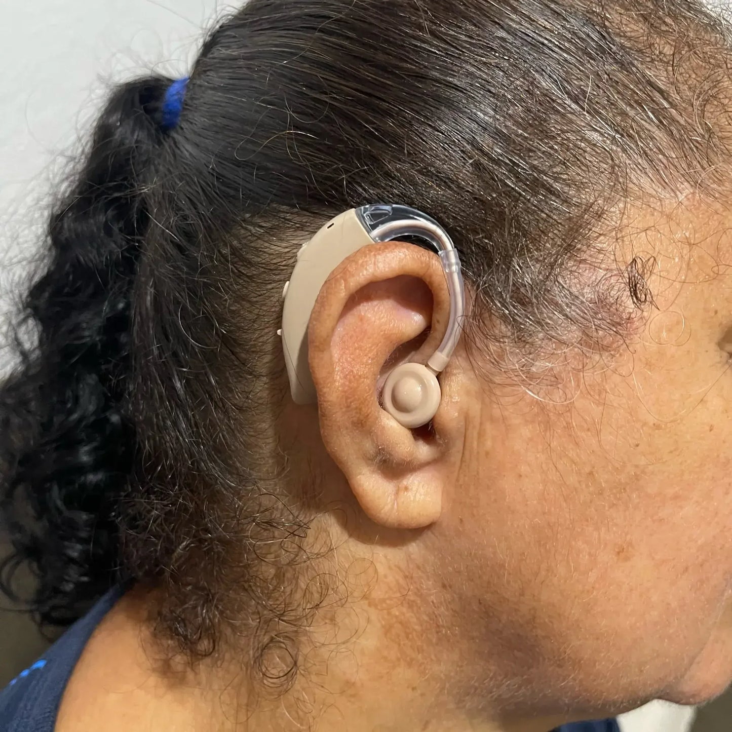 RYNX | Behind-The-Ear Hearing Aid - Powerful Sound Generation