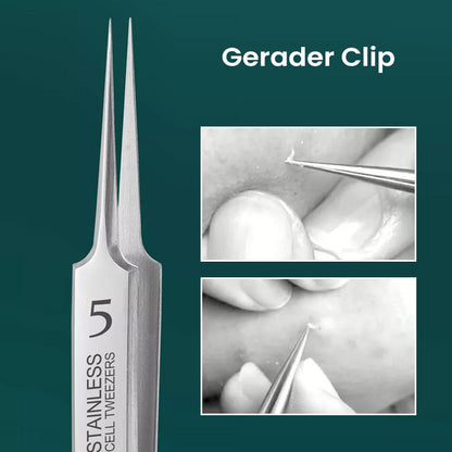 Rynx | Professional High-Precision Clip for Removing Blackheads