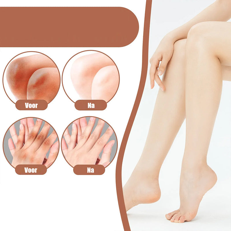 Rynx | Knees And Elbows Strong Bleach Cream