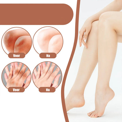 Rynx | Knees And Elbows Strong Bleach Cream