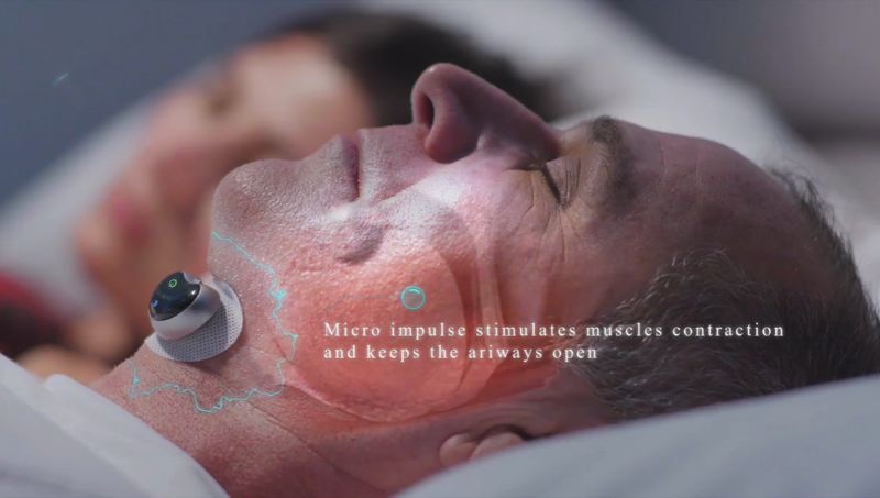 Rynx | SNORE CIRCLE - Bluetooth Anti-snoring Device Muscle Stimulator
