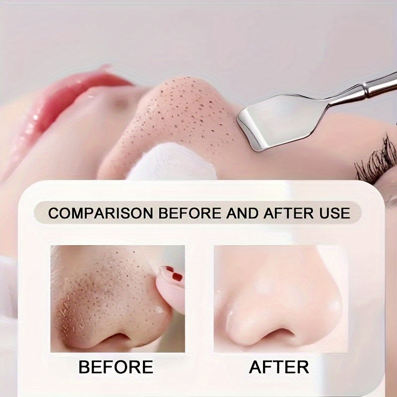 RYNX | Professional Blackhead Remover