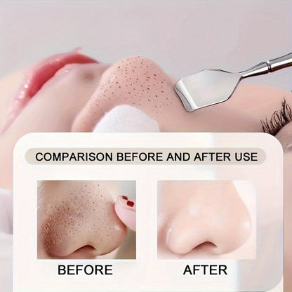 RYNX | Professional Blackhead Remover