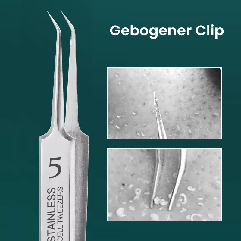 Rynx | Professional High-Precision Clip for Removing Blackheads