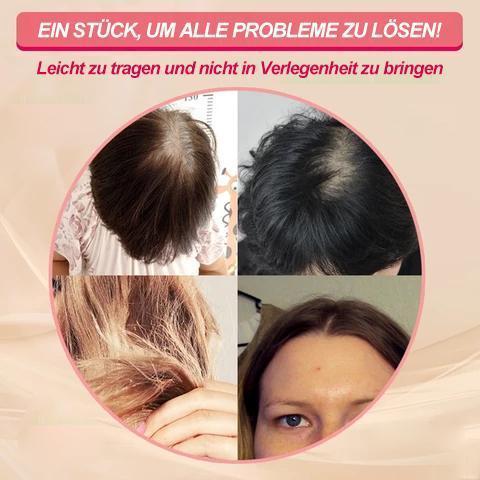 RYNX | Special Head Hairpiece