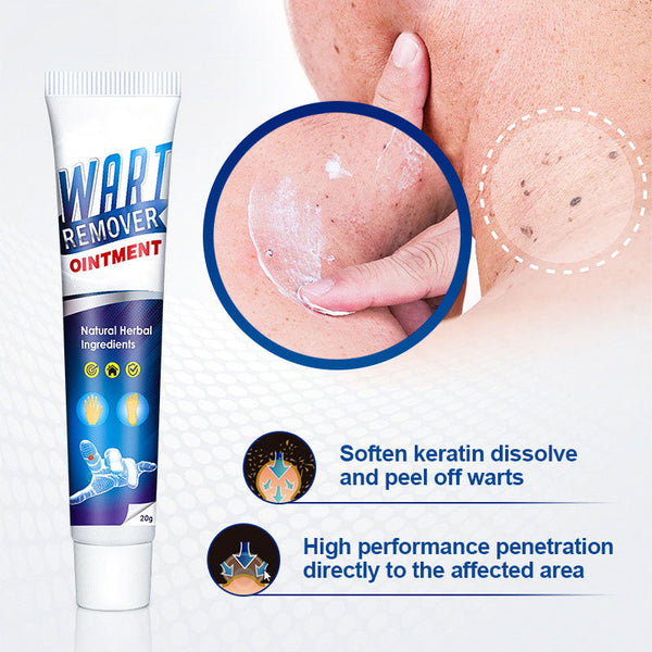 SkinEase Creme für Warzenentfernung und Pflege