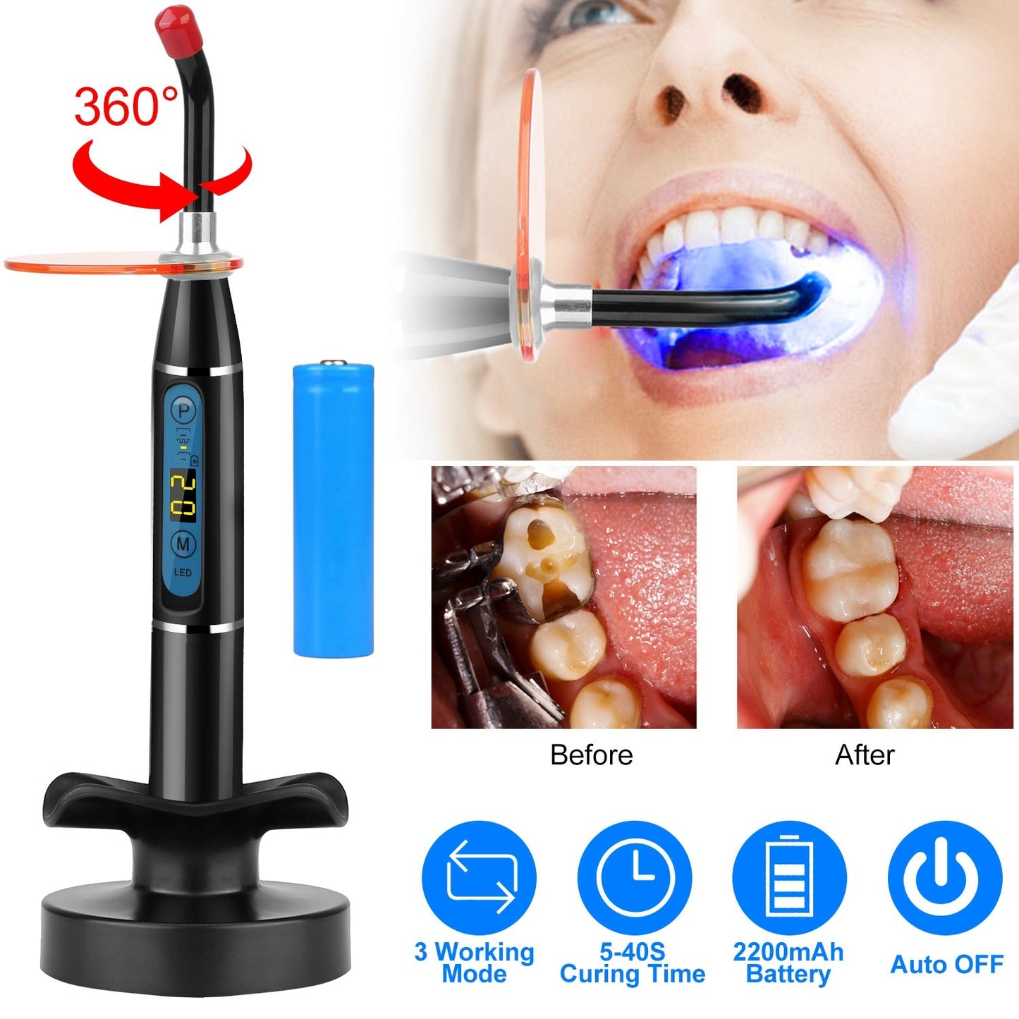 Rynx | 5W Wireless Dental LED Curing Light