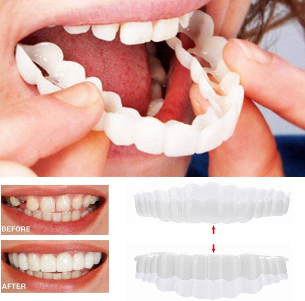Rynx | Smile Veneer (Top & Bottom Included)
