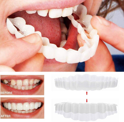 Rynx | Smile Veneer (Top & Bottom Included)