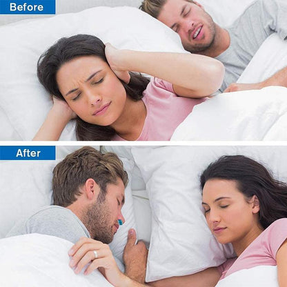 RYNX | Micro Cpap Anti-Snoring Electronic Device
