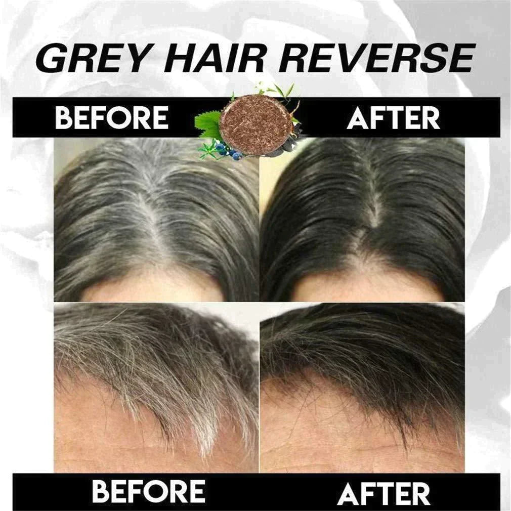 RYNX | Black Hair Dye Shampoo (Ayurvedic No Side Effect)