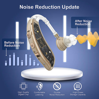 RYNX | Behind-The-Ear Hearing Aid - Powerful Sound Generation