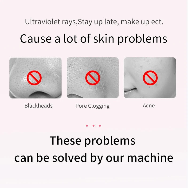 Rynx | Ultrasonic Skin Scrubber | Deep Cleansing Facial Peeling Spatula | Pore and Blackhead Removal Tool