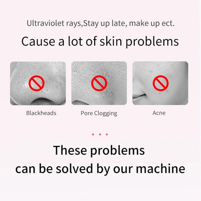 Rynx | Ultrasonic Skin Scrubber | Deep Cleansing Facial Peeling Spatula | Pore and Blackhead Removal Tool