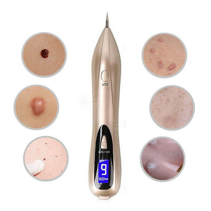 RYNX | Tag Remover Pen, Mole And Wart Removal