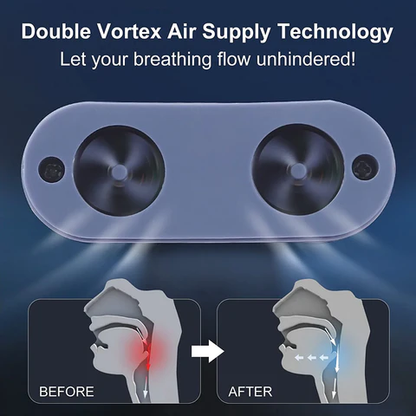 RYNX | Micro Cpap Sleep Apnea Machine For Travel & Anti-Snoring - Cpap Alternative