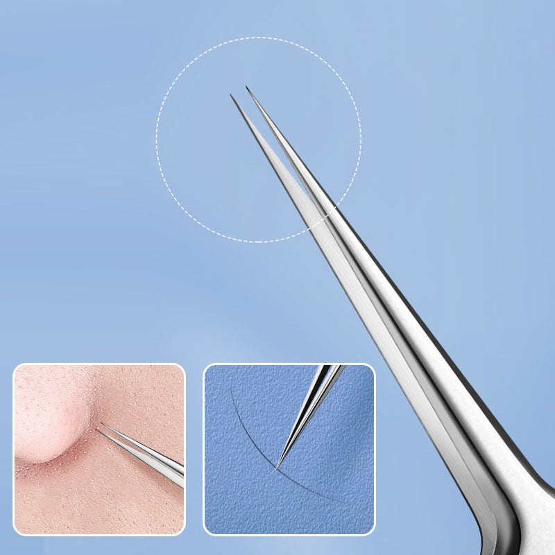 Rynx | Professional High-Precision Clip for Removing Blackheads