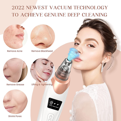 Rynx | Blackhead Remover Pore & Facial Pore Cleanse Vacuum