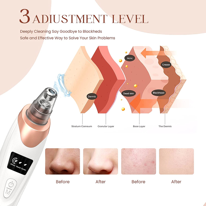 Rynx | Blackhead Remover Pore & Facial Pore Cleanse Vacuum