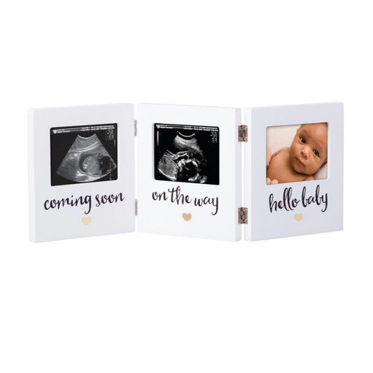 Rynx | 3 Image Sonogram Memory Frame, Gender Neutral Ultrasound Memory, 3.5”x2.5” Image Insertion