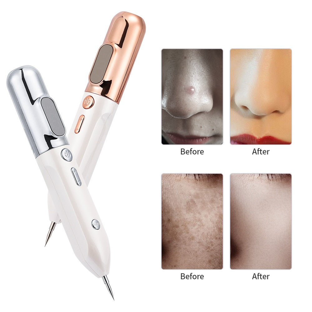 RYNX | Hexopen️ Wart & Skin Tag Removal Plasma Pen