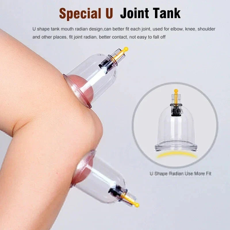 RYNX | 32-Glass Vacuum Cupping Set – Full Body Massage Therapy