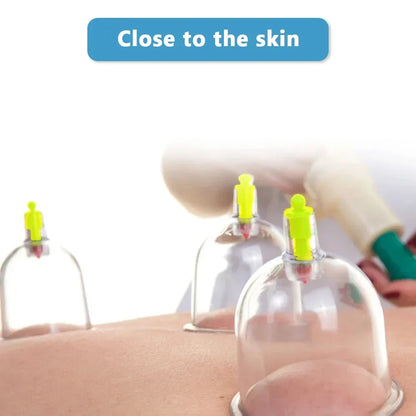 Rynx | 32-Glass Vacuum Cupping Set: Extensive Body Massage Care For Shoulders And More