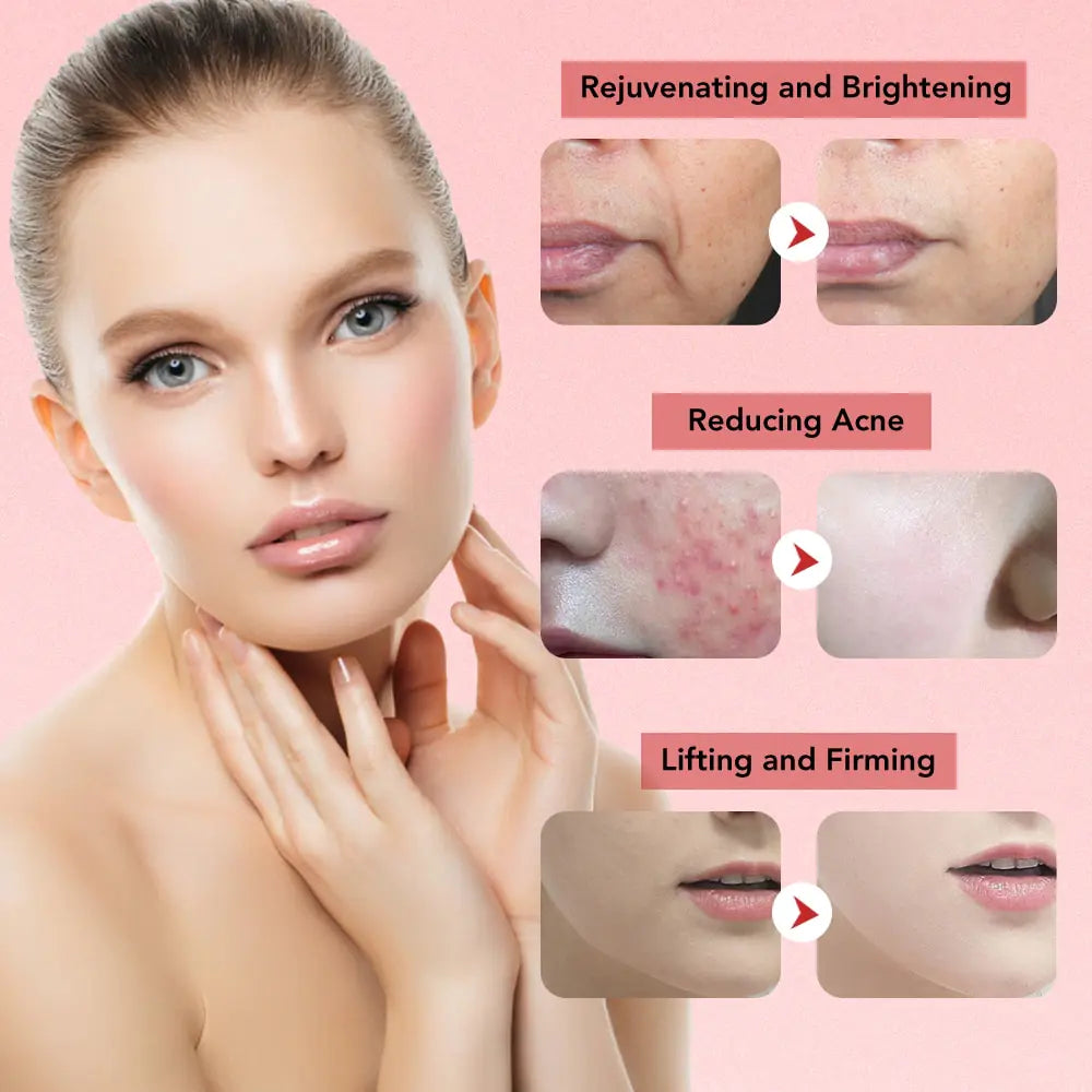 Rynx | Facial Massager Anti-Aging Therapy