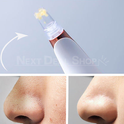Rynx | Electric Blackhead Remover Pore Vacuum