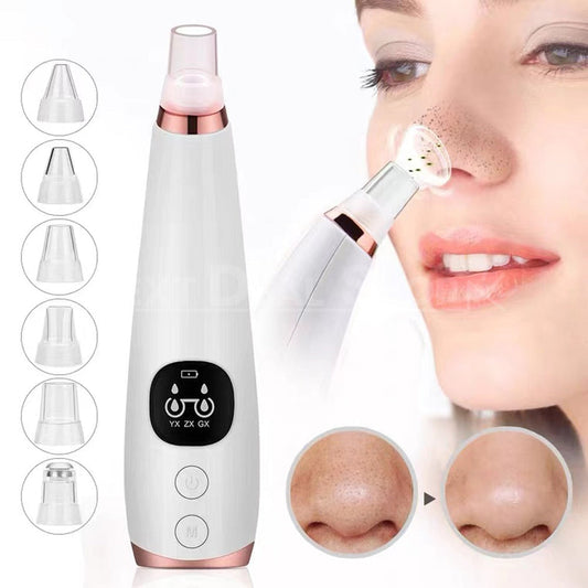 Rynx | Electric Blackhead Remover Pore Vacuum